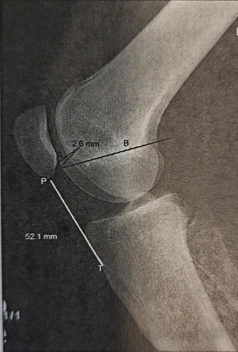 Lateral view