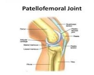 Patellofemoral_Joint